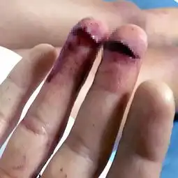 欧美嘉情侣在森林遭食人族掳走非礼,还险丧命