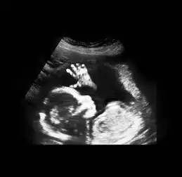 胎儿从卵泡到孕17周,17张图片清晰诠释,男宝女宝看得很清楚